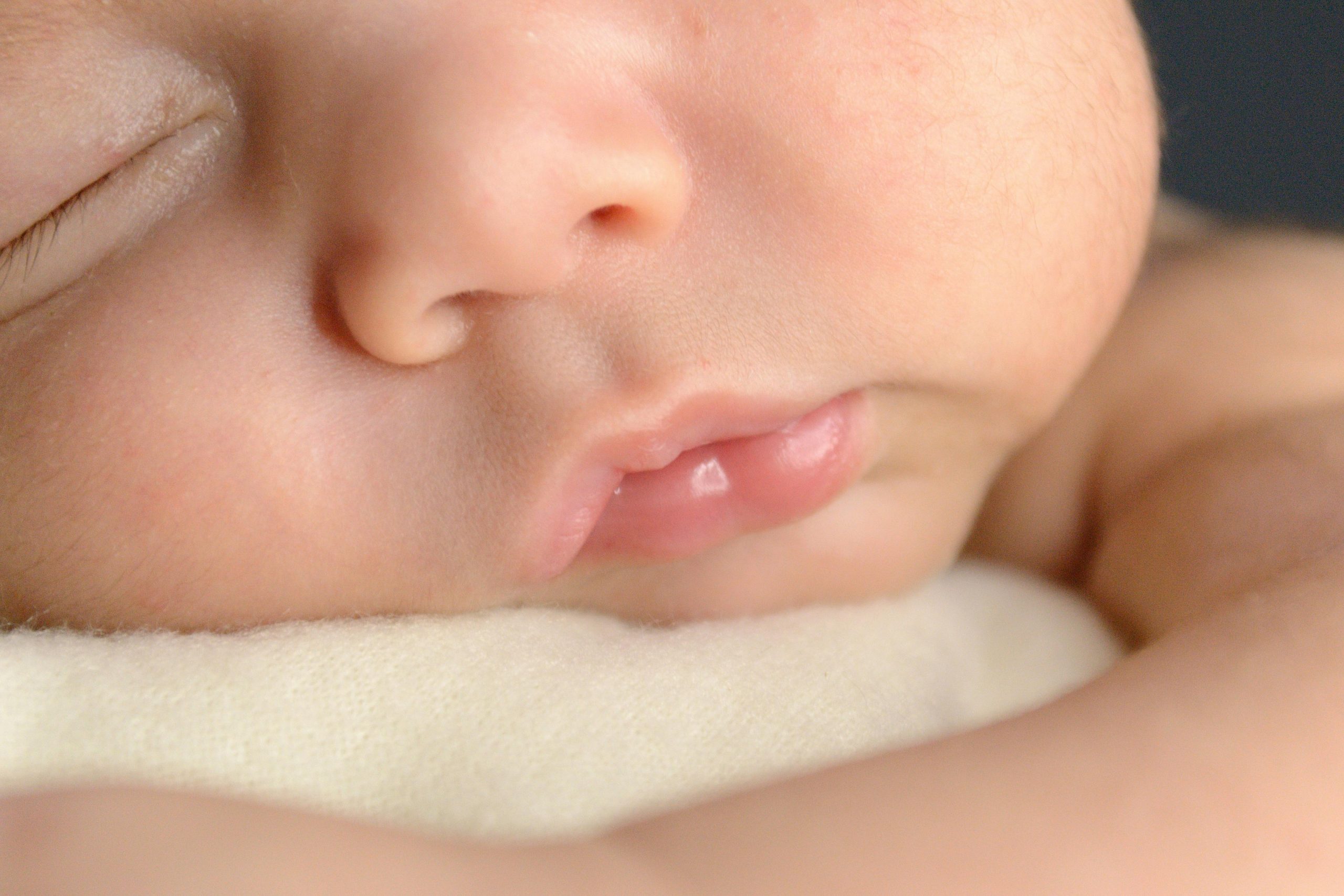 Point blanc gencive bébé solutions