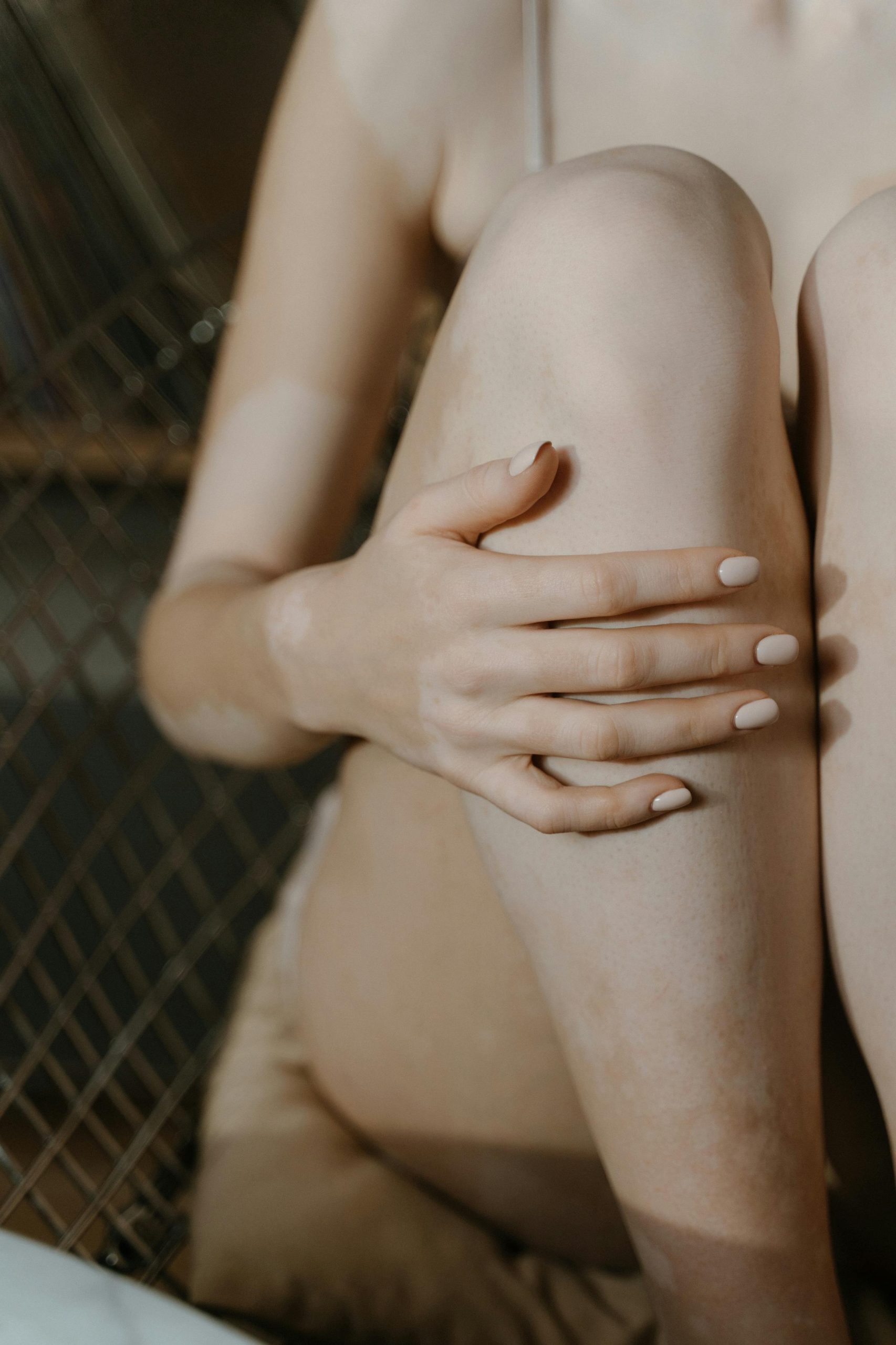 Close-up of a woman embracing her knee, showcasing vitiligo, promoting self-love and body positivity. Gros plan d'une femme embrassant son genou, mettant en avant le vitiligo, promouvant l'amour de soi et la positivité corporelle.