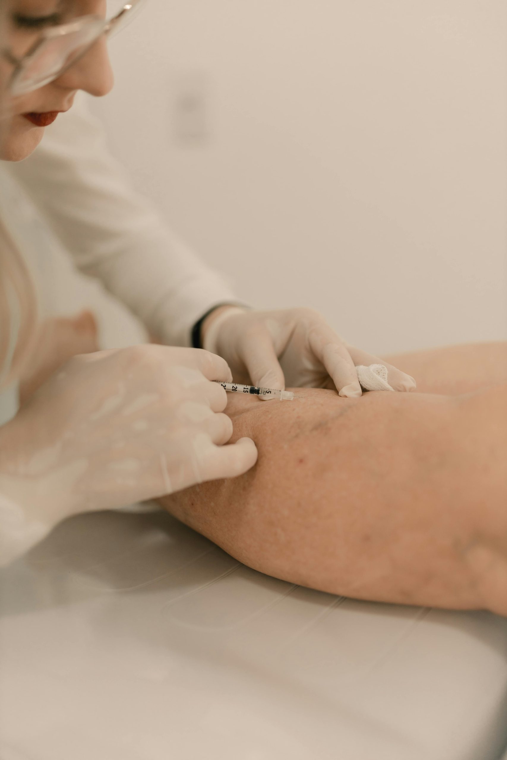 Avis Creamona crème varices