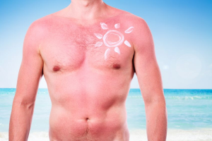Gélules solaires