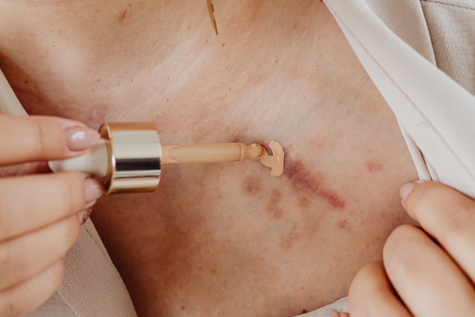 Application d une crème hydratante sur l épaule avec des mains soignées
