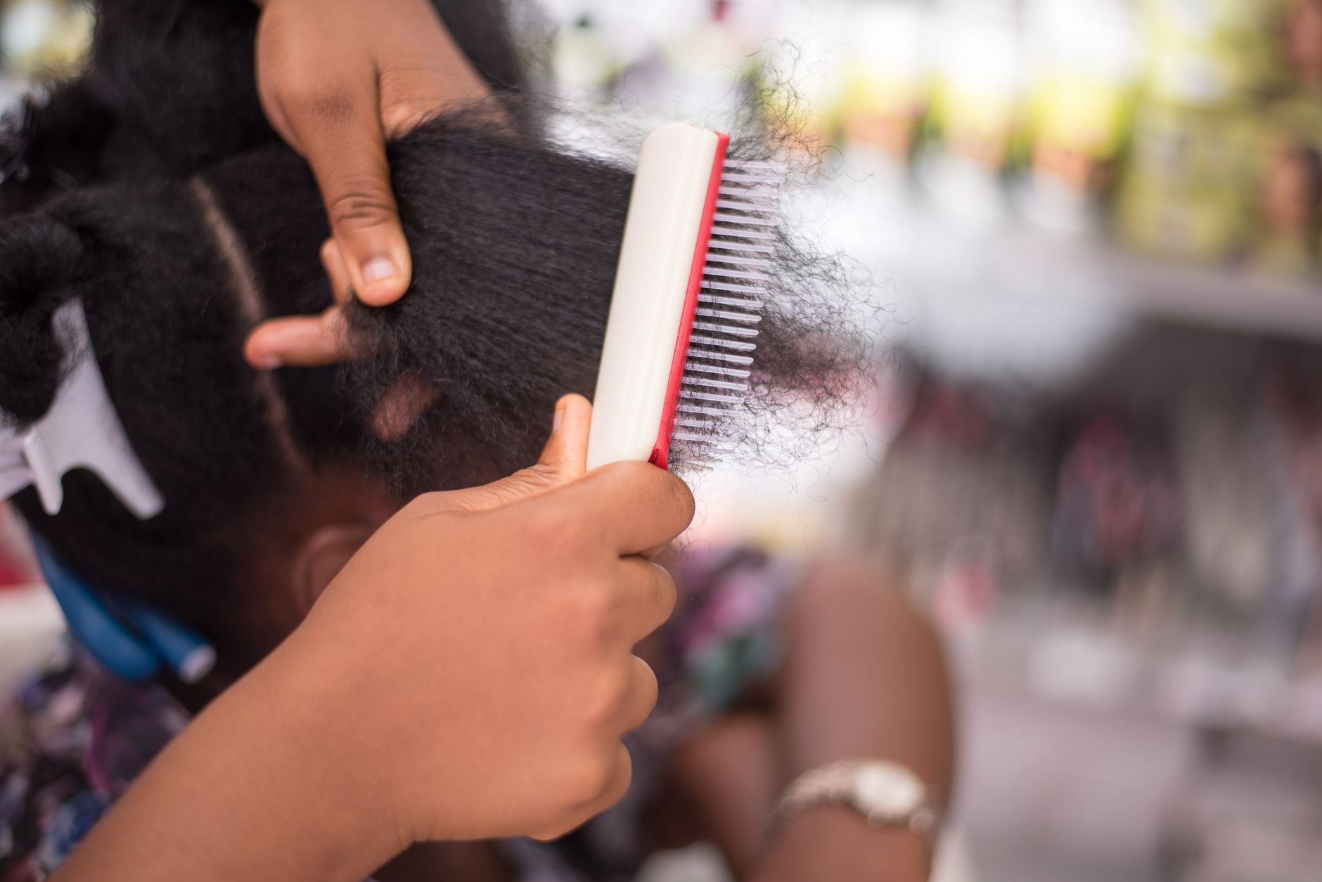 Cuir chevelu et cheveux vus de pres