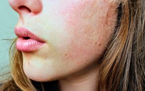 Gros plan sur la peau d’un visage de femme